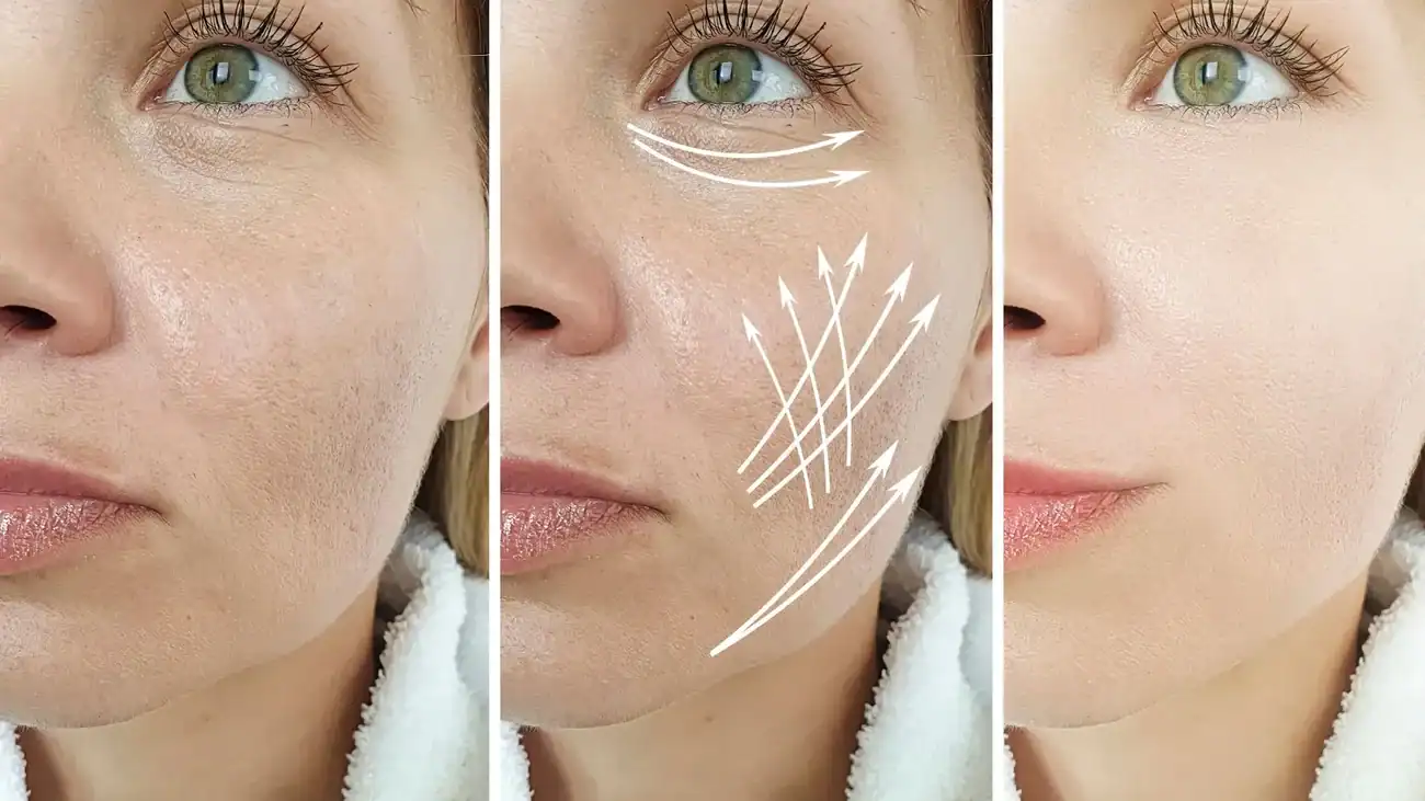 Can One Treatment Really Tackle More Than One Skin Concern Uxbridge?