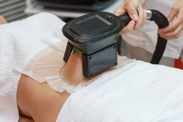 Image of person having fat freezing treatment to help weight gain Uxbridge