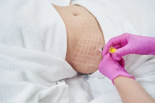 image of fat dissolving injections on love handles to help combat weight gain Uxbridge
