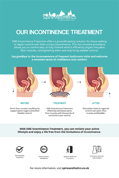 image to show how EMS treatment works for female urinary incontinence Uxbridge