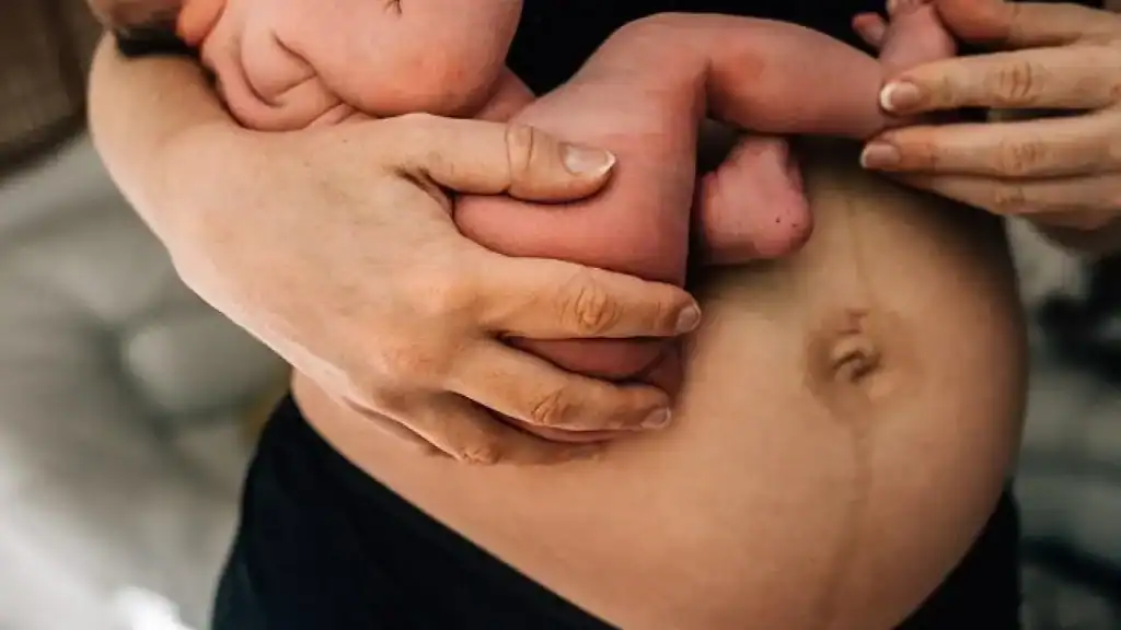 Why Is My Stomach Still Big After Pregnancy Uxbridge?