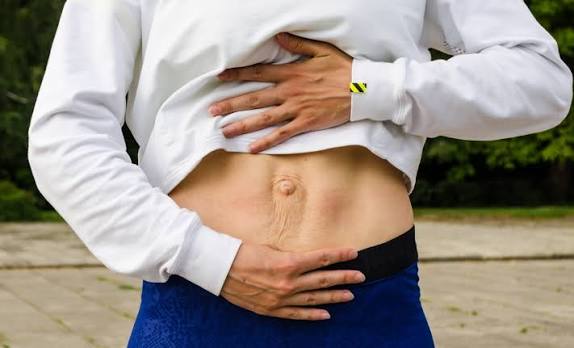 When Could Diastasis Recti Be the Missing Piece of the Puzzle Uxbridge?